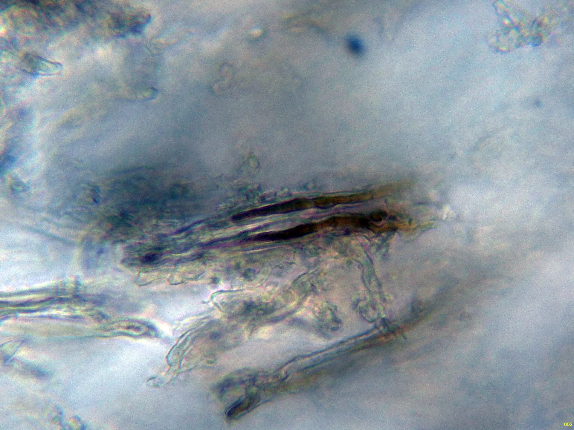 Microscopía de Stereum rugosum - 10 - Gloeocistidios agua-002